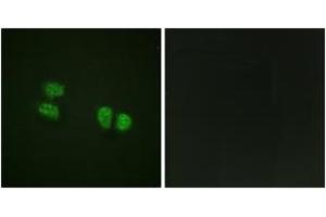Immunofluorescence analysis of HeLa cells, using DDX5/DEAD-box Protein 5 (Phospho-Tyr593) Antibody. (DDX5 Antikörper  (pTyr593))