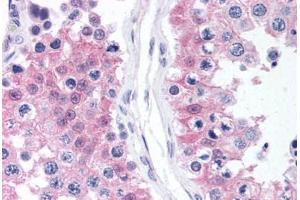 Human Testis (formalin-fixed, paraffin-embedded) stained with MAPK1 antibody ABIN218336 at 1:50 followed by biotinylated goat anti-rabbit IgG secondary antibody ABIN481713, alkaline phosphatase-streptavidin and chromogen. (ERK2 Antikörper  (C-Term))