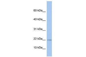 MPV17L antibody used at 1 ug/ml to detect target protein. (MPV17L Antikörper  (N-Term))