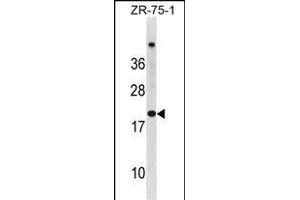 CDKN2A Antibody (N-term S8) (ABIN6243104 and ABIN6577380) western blot analysis in ZR-75-1 cell line lysates (35 μg/lane).