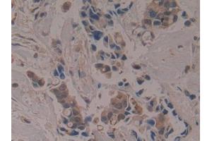Immunohistochemistry (IHC) image for anti-Apolipoprotein A-I Binding Protein (APOA1BP) (AA 118-282) antibody (ABIN7441091)