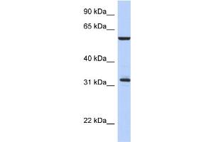 WB Suggested Anti-CDC34 Antibody Titration:  0. (CDC34 Antikörper  (Middle Region))