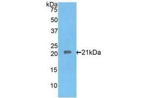 Western blot analysis of recombinant Rat IL17RE. (IL17RE Antikörper  (AA 457-626))