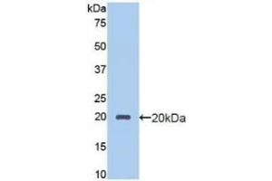 Detection of Recombinant PROCR, Human using Polyclonal Antibody to Endothelial protein C receptor (EPCR) (PROCR Antikörper  (AA 63-205))