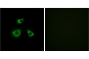 Immunofluorescence analysis of HuvEc cells, using MRPL52 Antibody. (MRPL52 Antikörper  (AA 71-120))