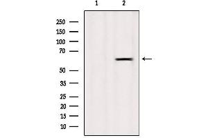 Western blot analysis of extracts from Mouse spleen, using LAT3 Antibody. (SLC43A1 Antikörper  (Internal Region))