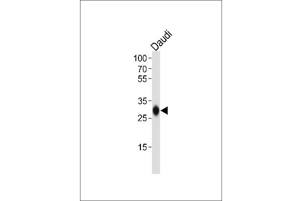 HLA-DQB1 Antikörper  (N-Term)