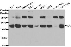 Western blot analysis of extracts of various cell lines, using ILK antibody. (ILK Antikörper  (AA 1-260))