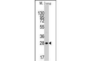Western blot analysis of CCND1 polyclonal antibody  in mouse lung tissue lysates (35 ug/lane). (Cyclin D1 Antikörper  (AA 147-175))