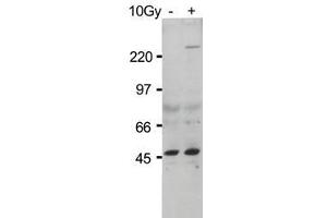 Anti-ATM Monoclonal Antibody - Western Blot. (ATM Antikörper  (pSer1981) (HRP))