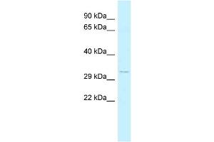 WB Suggested Anti-FOXK2 Antibody Titration: 1. (Forkhead Box K2 Antikörper  (C-Term))