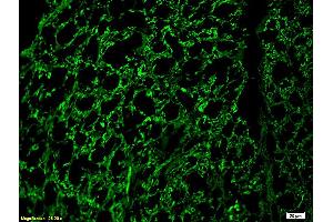 Formalin-fixed and paraffin embedded rat spinal cord labeled with Rabbit Anti-NF-H/Neurofilament H/Neurofilament 200 Polyclonal Antibody (ABIN672156), Unconjugated 1:200 followed by conjugation to the secondary antibody and DAB staining. (NEFH Antikörper  (AA 1-100))