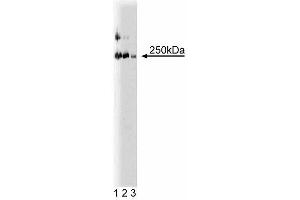 Western blot analysis of LR11 on a rat cerebrum lysate. (SORL1 Antikörper  (AA 1220-1337))