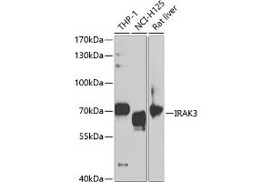 Western blot analysis of extracts of various cell lines, using IR antibody (ABIN6130501, ABIN6142519, ABIN6142521 and ABIN6221129) at 1:1000 dilution. (IRAK3 Antikörper  (AA 367-596))