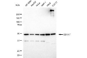 Western blotting analysis using DDOST antibody (ABIN7798383). (DDOST Antikörper)