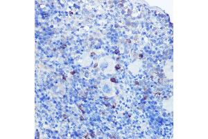 Immunohistochemistry of paraffin-embedded mouse spleen using TLR9 Rabbit pAb (ABIN7270849) at dilution of 1:100 (40x lens). (TLR9 Antikörper  (AA 350-450))