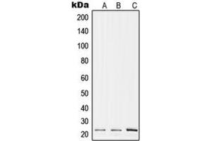Western blot analysis of RPL17 expression in A375 (A), Raw264. (RPL17 Antikörper  (Center))