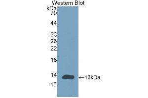 Detection of Recombinant CHRNa1, Human using Polyclonal Antibody to Cholinergic Receptor, Nicotinic, Alpha 1 (CHRNa1) (CHRNA1 Antikörper  (AA 21-255))