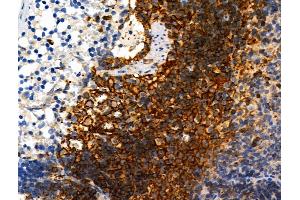 Phospho-ZO-2 (Tyr1118) Antibody at 1/100 staining Rat spleen tissue by IHC-P. (TJP2 Antikörper  (pTyr1118))