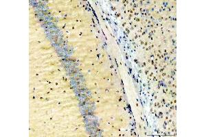 IHC analysis of NFIA using anti-NFIA antibody (ABIN4886680). (NFIA Antikörper  (Middle Region))