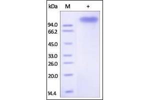 Human ErbB4, Fc Tag on SDS-PAGE under reducing (R) condition. (ERBB4 Protein (AA 26-651) (Fc Tag))