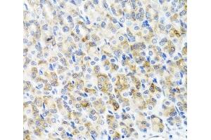 Immunohistochemistry of paraffin-embedded Mouse stomach using RAD51C Polyclonal Antibody at dilution of 1:100 (40x lens). (RAD51C Antikörper)