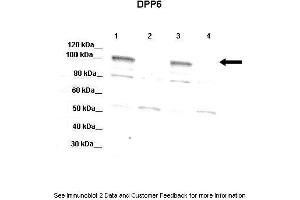 Lanes:   Lane 1: 20ug mouse WT brain extract  Lnae 2: DPP6 -/- mouse brain extract  Lane 3: 20ug mouse WT brain extract  4: DPP6 -/- mouse brain extract  Primary Antibody Dilution:   1:1000  Secondary Antibody:   Donkey anti-rabbit-HRP  Secondary Antibody Dilution:   1:10,000  Gene Name:   DPP6 a  Submitted by:   Jeanne M. (DPP6 Antikörper  (Middle Region))