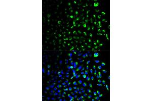 Immunofluorescence analysis of U2OS cell using HK1 antibody. (Hexokinase 1 Antikörper)