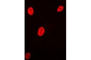Immunofluorescent analysis of Brn-5 staining in MCF7 cells. (POU6F1 Antikörper)