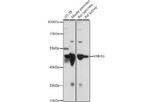 Western blot analysis of extracts of various cell lines, using HNF4G antibody (ABIN7267620) at 1:1000 dilution. (HNF4 gamma Antikörper  (AA 366-445))