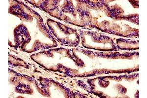 Immunohistochemistry of paraffin-embedded human prostate tissue using ABIN7148337 at dilution of 1:100 (C1QC Antikörper  (AA 27-157))