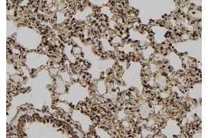 ABIN6277425 at 1/100 staining Rat lung tissue by IHC-P. (PDX1 Antikörper  (Internal Region))