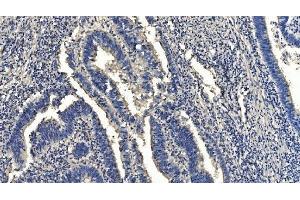IHC analysis of HYI using anti-HYI antibody (ABIN7601796). (HYI Antikörper  (AA 46-277))