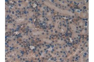 Detection of ND5 in Rat Kidney Tissue using Polyclonal Antibody to NADH Dehydrogenase 5 (ND5) (MT-ND5 Antikörper  (AA 425-562))