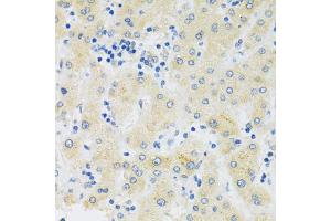 Immunohistochemistry of paraffin-embedded human liver using SLC39A7 antibody (ABIN5971725) at dilution of 1/100 (40x lens). (SLC39A7 Antikörper)