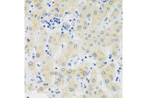Immunohistochemistry of paraffin-embedded human liver using SLC39A7 antibody (ABIN5971725) at dilution of 1/100 (40x lens).