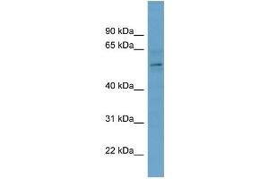 WB Suggested Anti-CBX2  Antibody Titration: 0. (CBX2 Antikörper  (Middle Region))