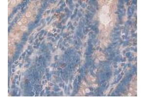 IHC-P analysis of Rat Intestine Tissue, with DAB staining. (Growth Hormone Receptor Antikörper  (AA 353-588))