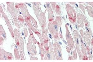 Detection of DSG2 in Human Heart Tissue using Polyclonal Antibody to Desmoglein 2 (DSG2)