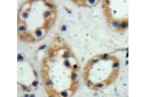 Immunohistochemistry (IHC) image for anti-Polymeric Immunoglobulin Receptor (PIGR) (AA 230-331) antibody (ABIN5014138)