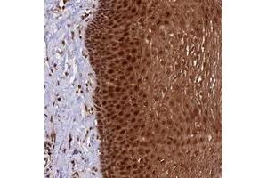 Immunohistochemical staining of human esophagus with DHX38 polyclonal antibody  shows strong cytoplasmic and nuclear positivity in squamous epithelial cells at 1:50-1:200 dilution. (DHX38 Antikörper)