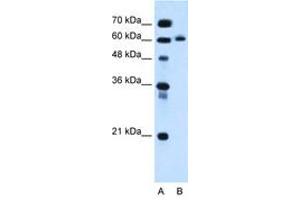 Image no. 1 for anti-Inositol 1,4,5-Triphosphate Receptor Interacting Protein-Like 1 (ITPRIPL1) (AA 402-451) antibody (ABIN6736675) (ITPRIPL1 Antikörper  (AA 402-451))