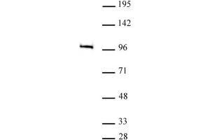 MED15 antibody (pAb) tested by Immunoprecipitation. (MED15 Antikörper  (C-Term))