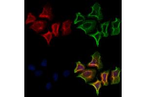 ABIN6261709 and ABIN6273117 staining Hela cells by IF/ICC. (FECH Antikörper  (C-Term))