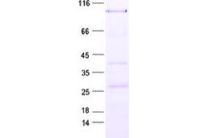 Western Blotting (WB) image for Hypermethylated in Cancer 2 (HIC2) protein (His tag) (ABIN2722723)