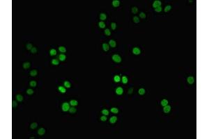 Immunofluorescent analysis of PC-3 cells using ABIN7161579 at dilution of 1:100 and Alexa Fluor 488-congugated AffiniPure Goat Anti-Rabbit IgG(H+L) (NMNAT1 Antikörper  (AA 1-279))