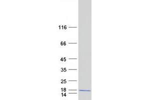 ADIG Protein (Myc-DYKDDDDK Tag)