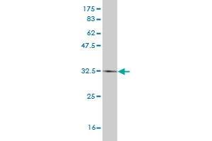 Western Blot detection against Immunogen (34. (HAND2 Antikörper  (AA 135-216))