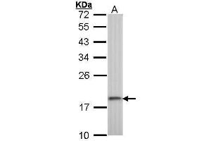 WB Image Sample (30 ug of whole cell lysate) A: A431 , 12% SDS PAGE antibody diluted at 1:1000 (RPS10 Antikörper)