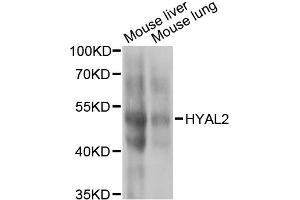 Western blot analysis of extracts of various cell lines, using HYAL2 antibody (ABIN2563308) at 1:1000 dilution. (HYAL2 Antikörper)